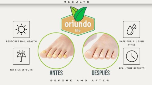 PRESENTAMOS.... Oxilook! Nail Nippers (1) PRESENTAMOS.... Oxilook! Nail Nippers (1)