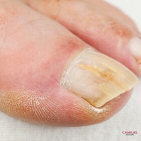 SDL Scalp Relief Calmin Tonic (7)